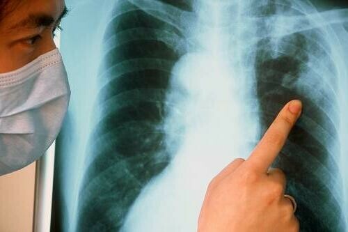 На Дальнем Востоке еще у одной сотрудницы школы выявили туберкулез Под угрозой ЕГЭ