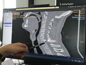 Про такие раны говорят попасть белке в глаз благовещенцу во время отдыха на природе пуля пробила позвоночник